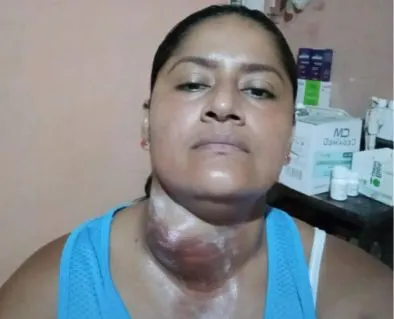 Help Patricia With Morphine and Treatment for Her Son