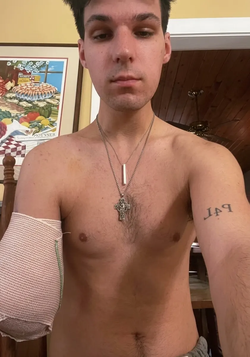 Help George Continue His Cancer Treatment and Get a Prosthetic Arm
