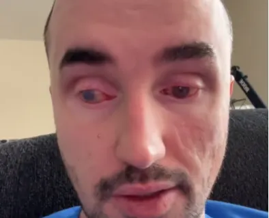 Help Noah Afford Scleral Lenses and Eye Surgery β photo 1