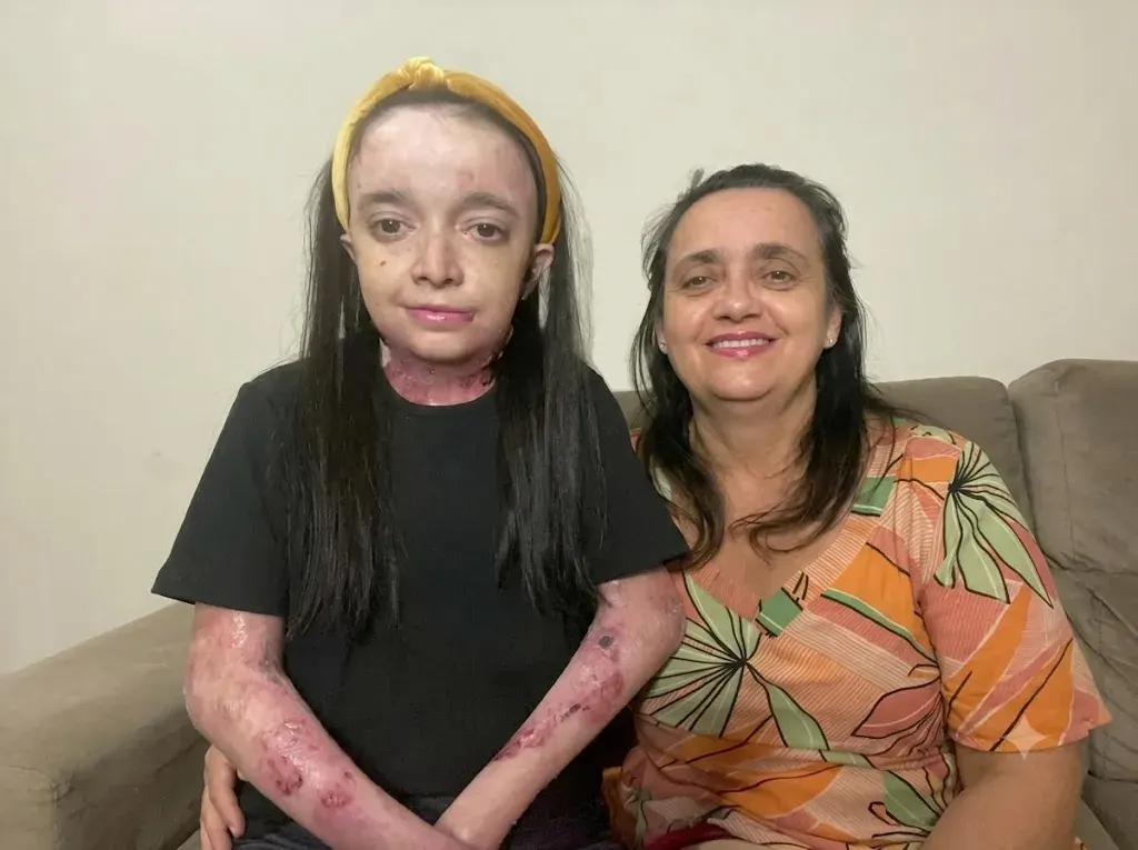 Help Adrieli Access Ongoing Epidermolysis Bullosa Care