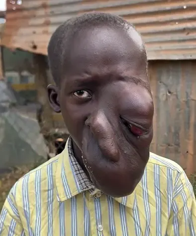 Akin Has 6 Months to Live — Be His Only Hope