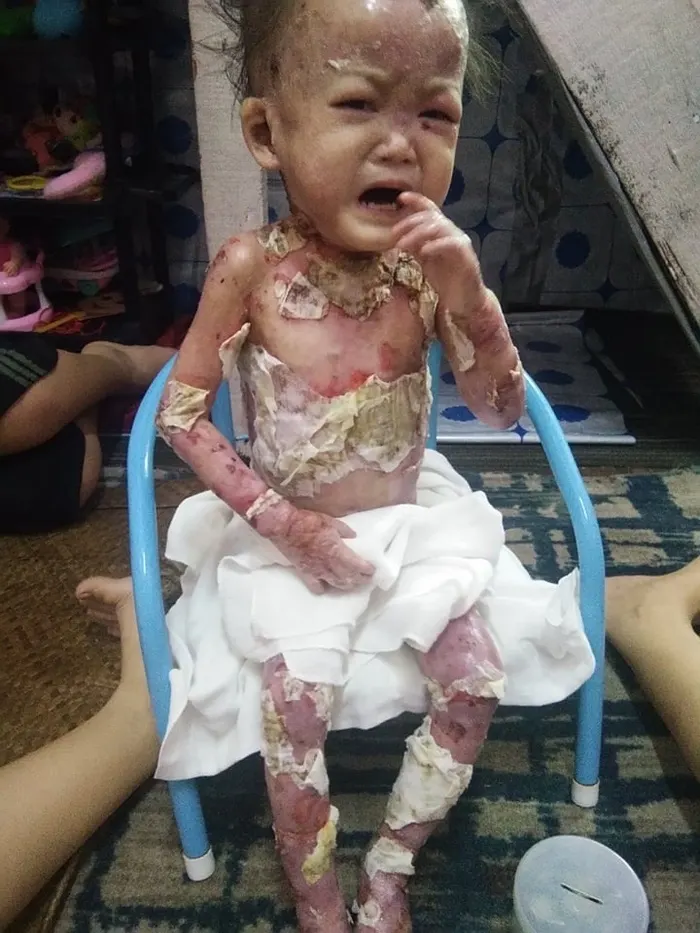 Please Donate to Stop Lily's Severe Pain and Help Save Her Life — photo 1